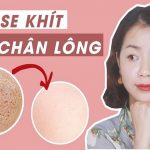 Cách làm se khít lỗ chân lông từ thiên nhiên